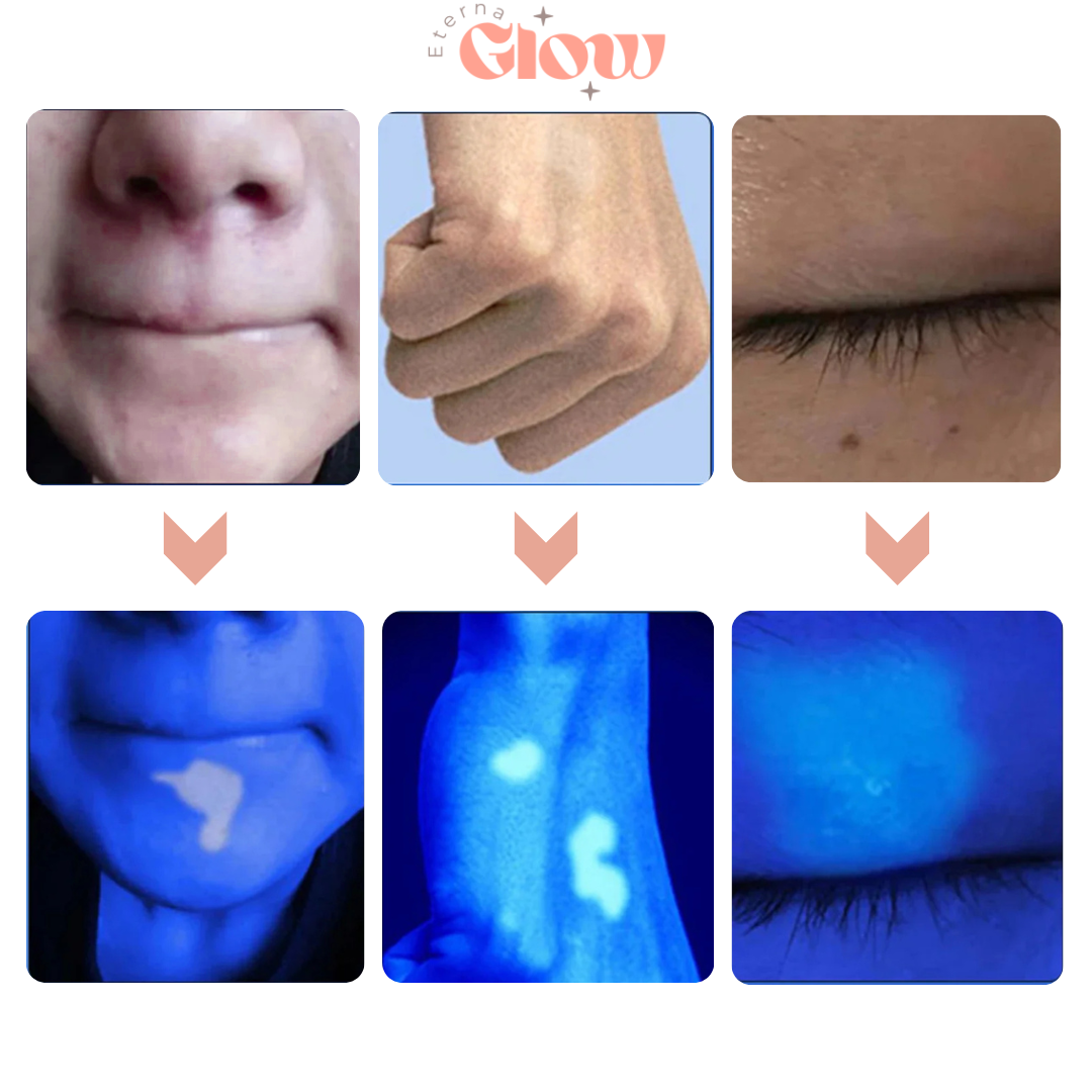 GlowScope Skin Analyzer