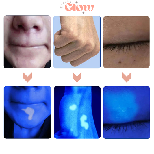 GlowScope Skin Analyzer