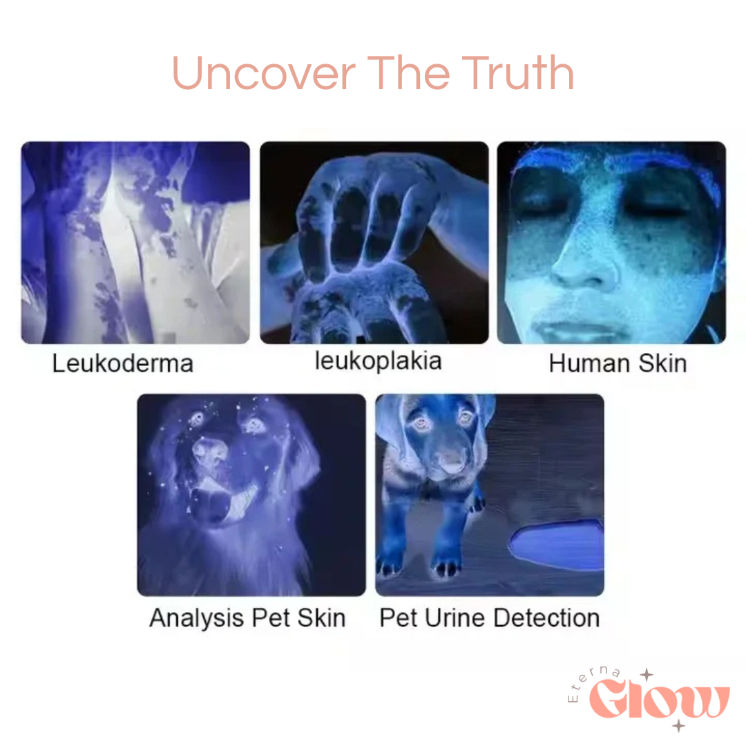 GlowScope Skin Analyzer