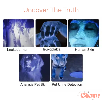 GlowScope Skin Analyzer